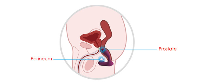 Máy rung hậu môn Svakom Vicky